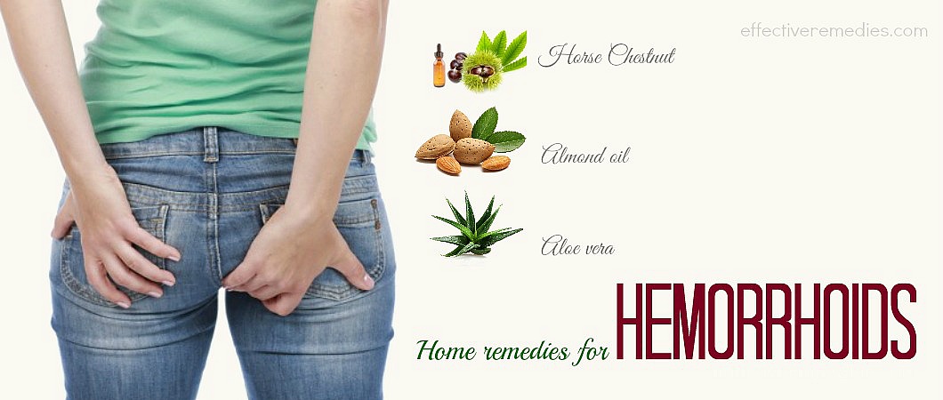 home-remedies-for-hemorrhoids1